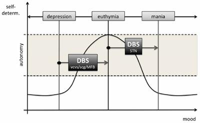 Autonomy in Depressive Patients Undergoing DBS-Treatment: Informed Consent, Freedom of Will and DBS’ Potential to Restore It